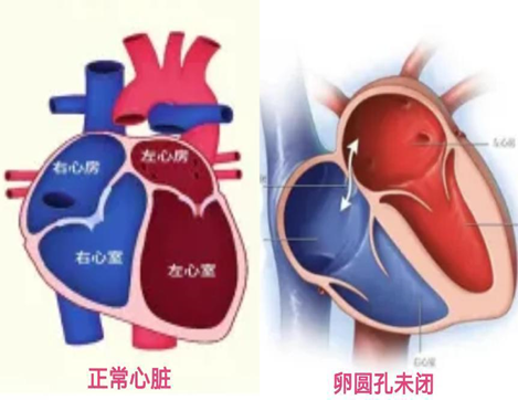 66164b5a22d9a.png